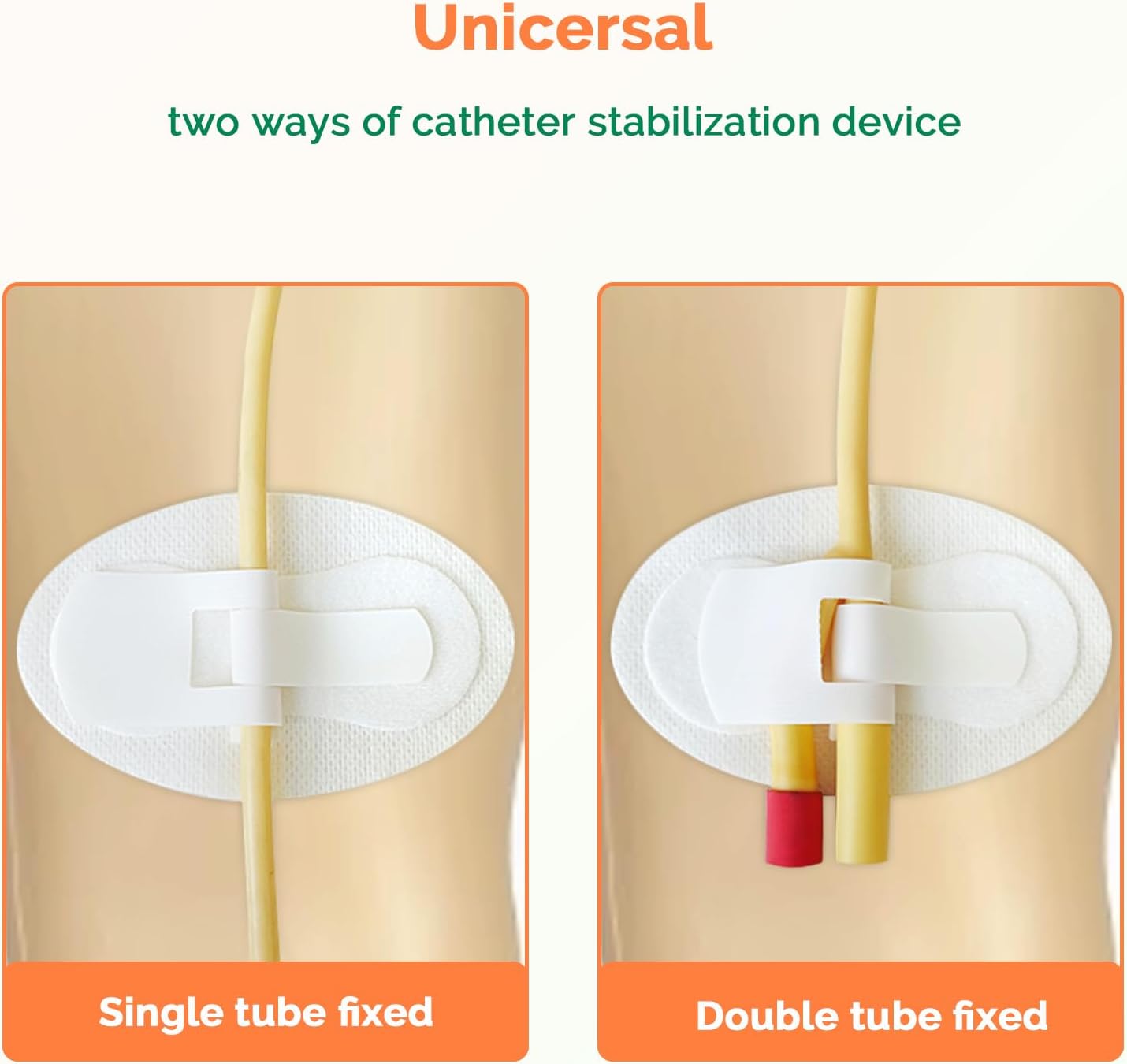 Foley Tie Velcro Catheter Device - C0611 (4/Pack)