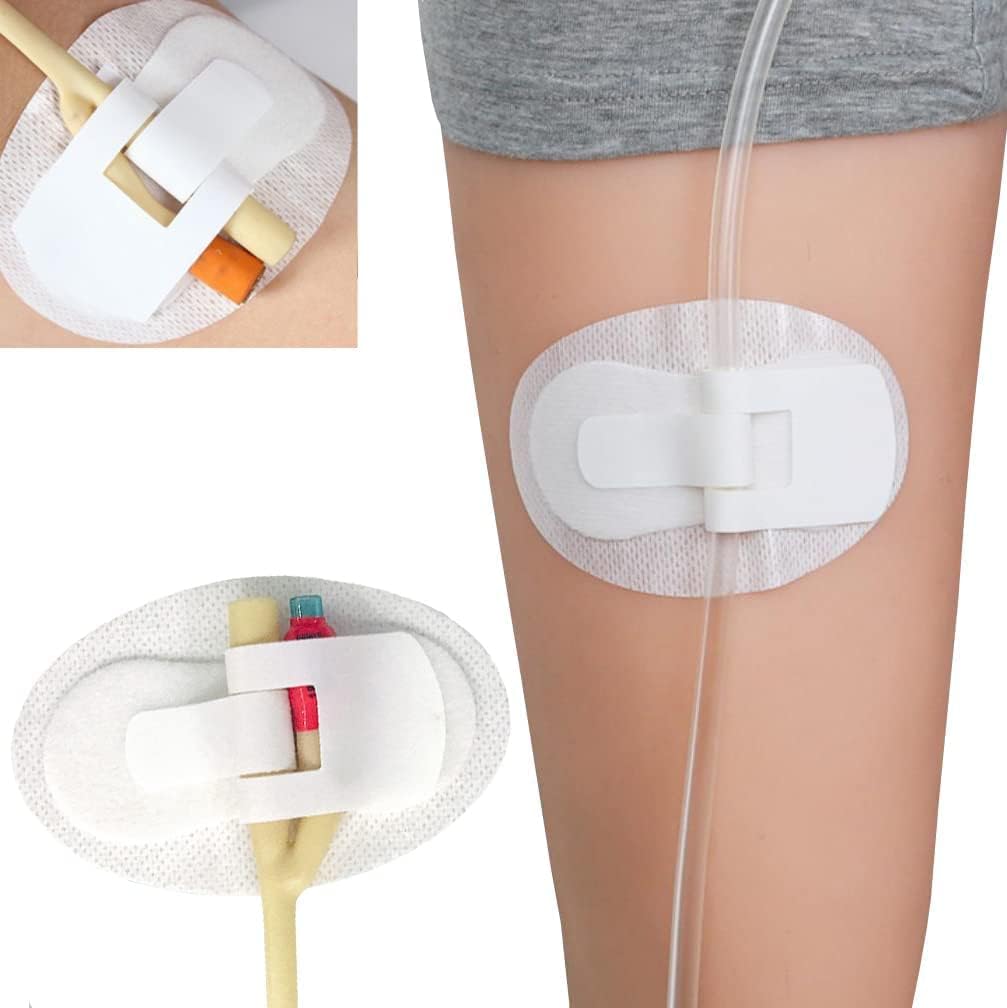 Foley Tie Velcro Catheter Device - C0611 (4/Pack)