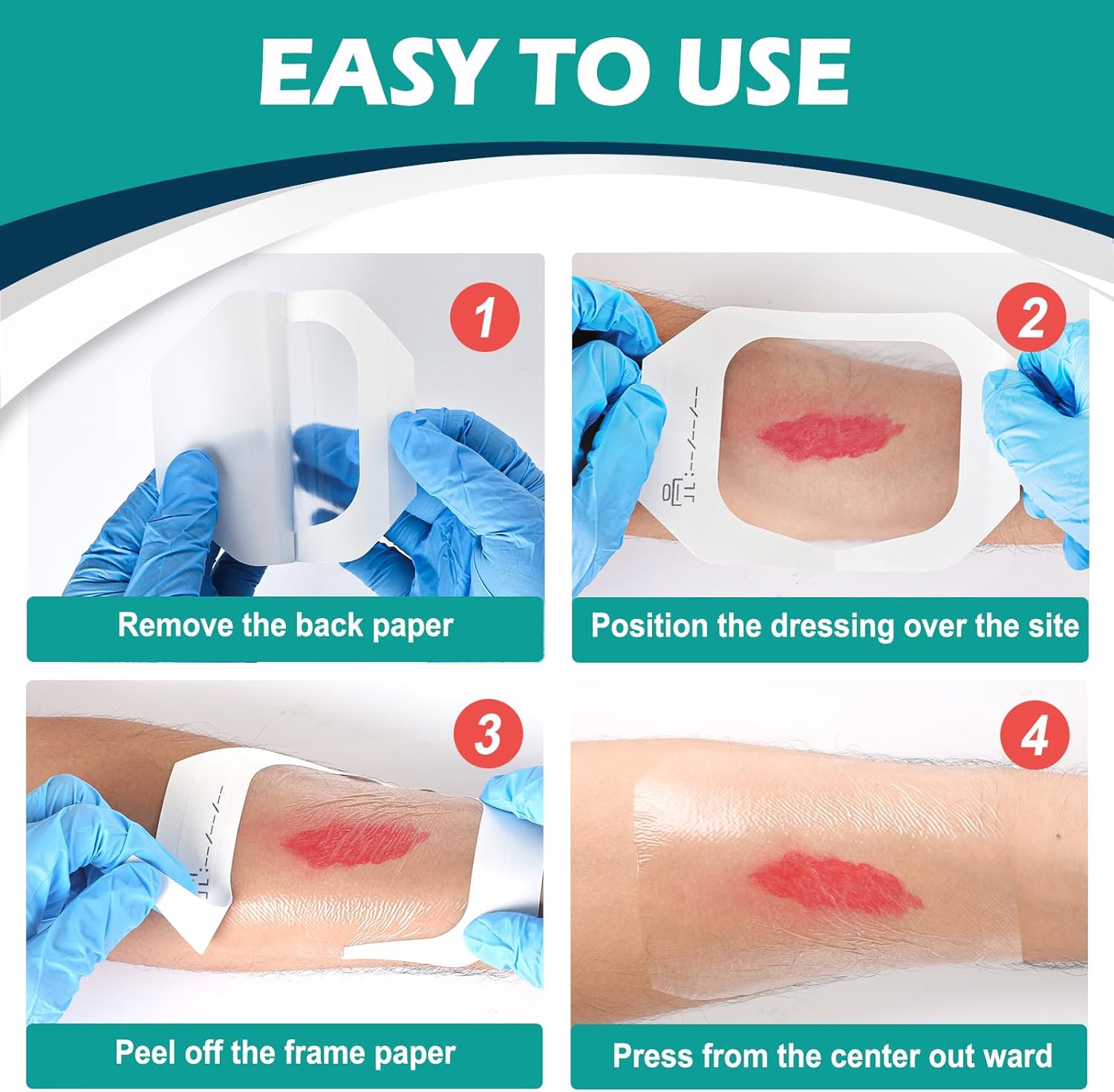 Transparent Pressure Ulcer Film IV Dressing (Tegaderm - 10cm x 12cm) (25 pack)