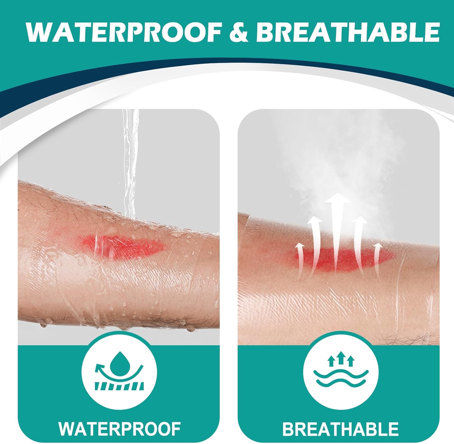 Transparent Pressure Ulcer Film IV Dressing (Tegaderm Transparent Pressure Ulcer Film IV Dressing (Tegaderm