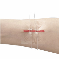 Wound Closure Device Zip Suture 2in x 3in 4/Pack