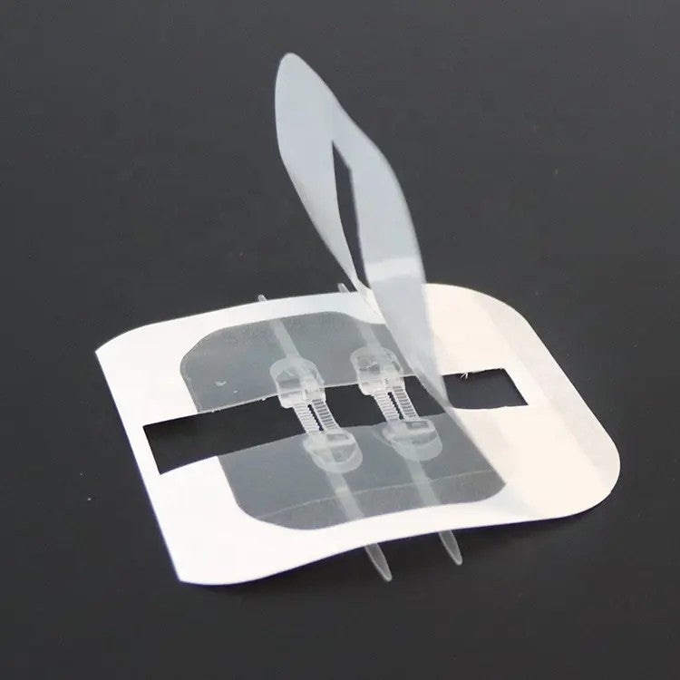 Zipper Pacemaker Closure Device Wound Closure Device Zip Suture 2in x 3in 4/Pack – Kerae Medical Inc.