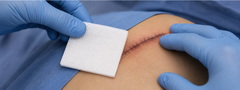 Kerae non-woven gauze sponges in use during a clinical wound dressing change